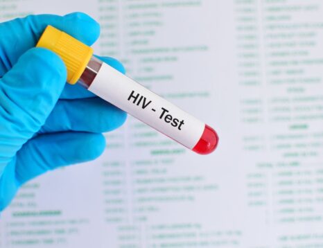 HIV test